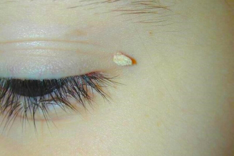 Источник фото: cakarelia.ru 